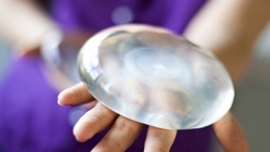 Implantes mamarios: todo lo que tenés que saber