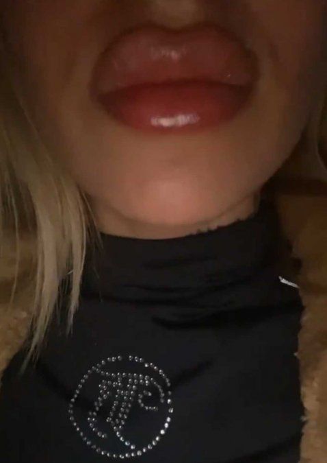 Tamara Báez mostró sus labios carnosos.