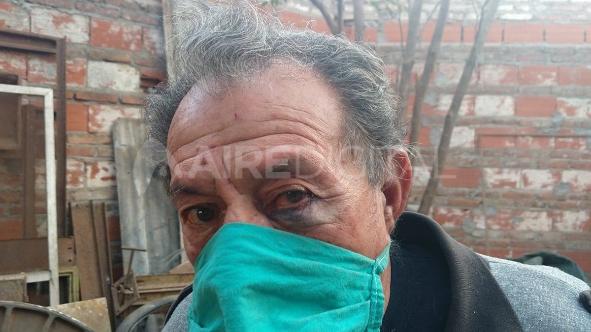 Golpes de puño. Me siento muy dolorido