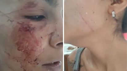 Mar del Plata: dos mujeres llevaron engañada a su amiga a un descampado y le cortaron la cara