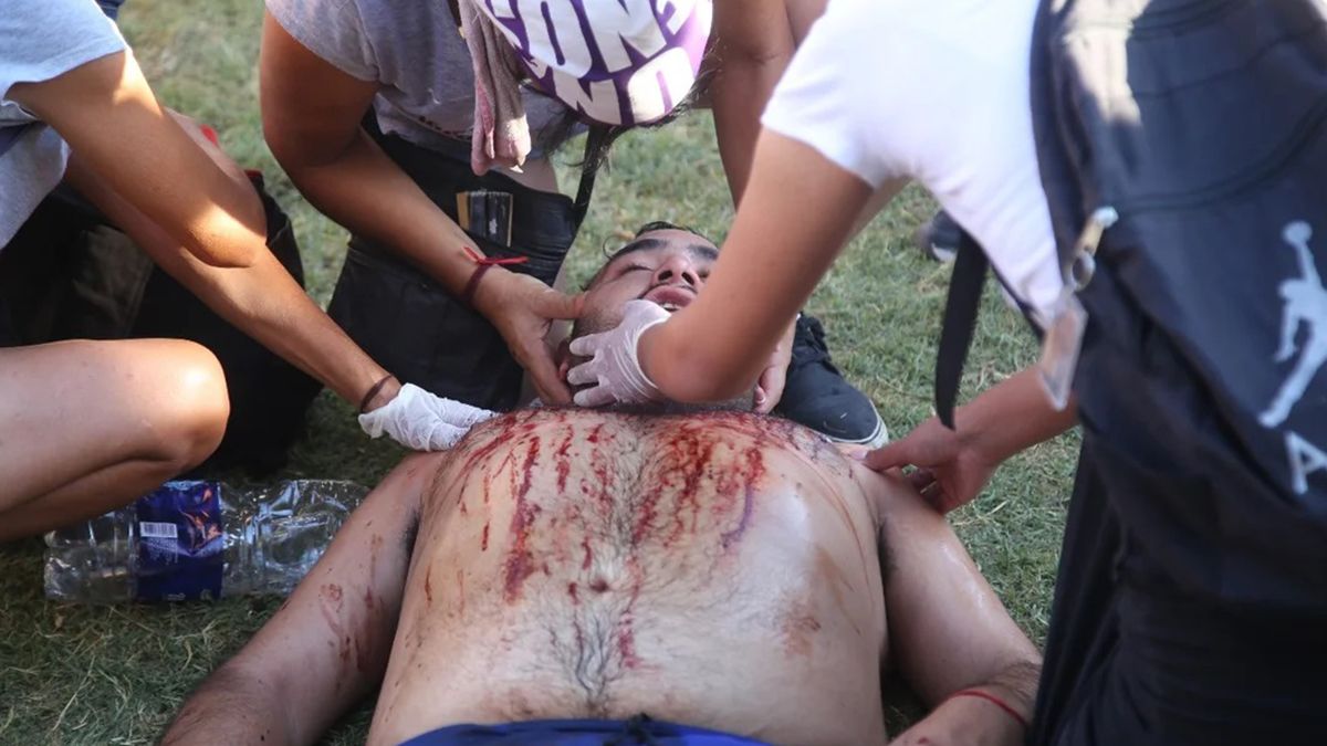 Un militante fue herido en la mandíbula y recibió atención en la Plaza del Congreso. Un militante fue herido en la mandíbula y recibió atención en la Plaza del Congreso.