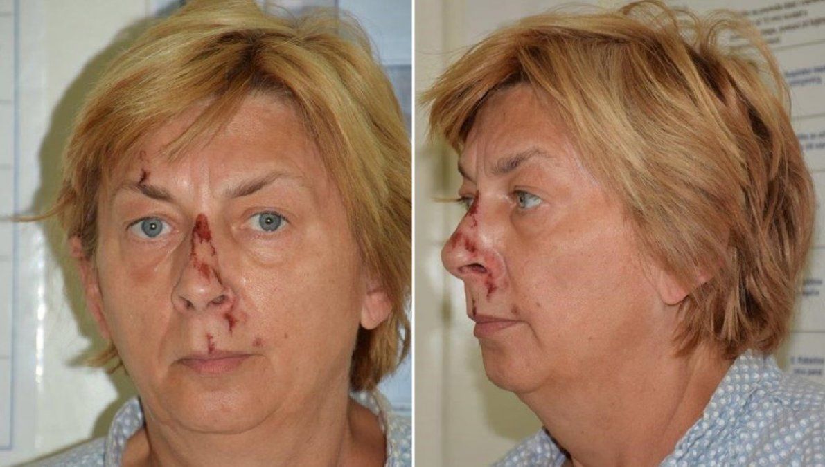 La mujer se encuentra actualmente hospitalizada.
