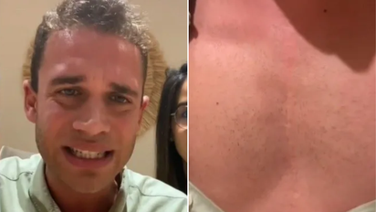 Video viral: lo operaron a corazón abierto por culpa de una peligrosa práctica que muchos realizan