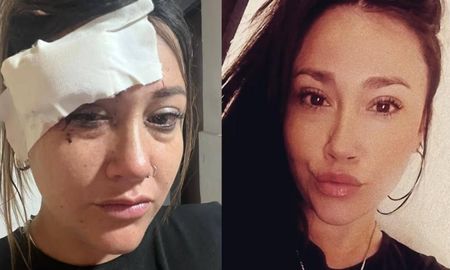 Ana Segovia terminó con una herida profunda cerca del ojo que requirió 10 puntos de sutura tras el ataque con la copa rota. Ana Segovia terminó con una herida profunda cerca del ojo que requirió 10 puntos de sutura tras el ataque con la copa rota.