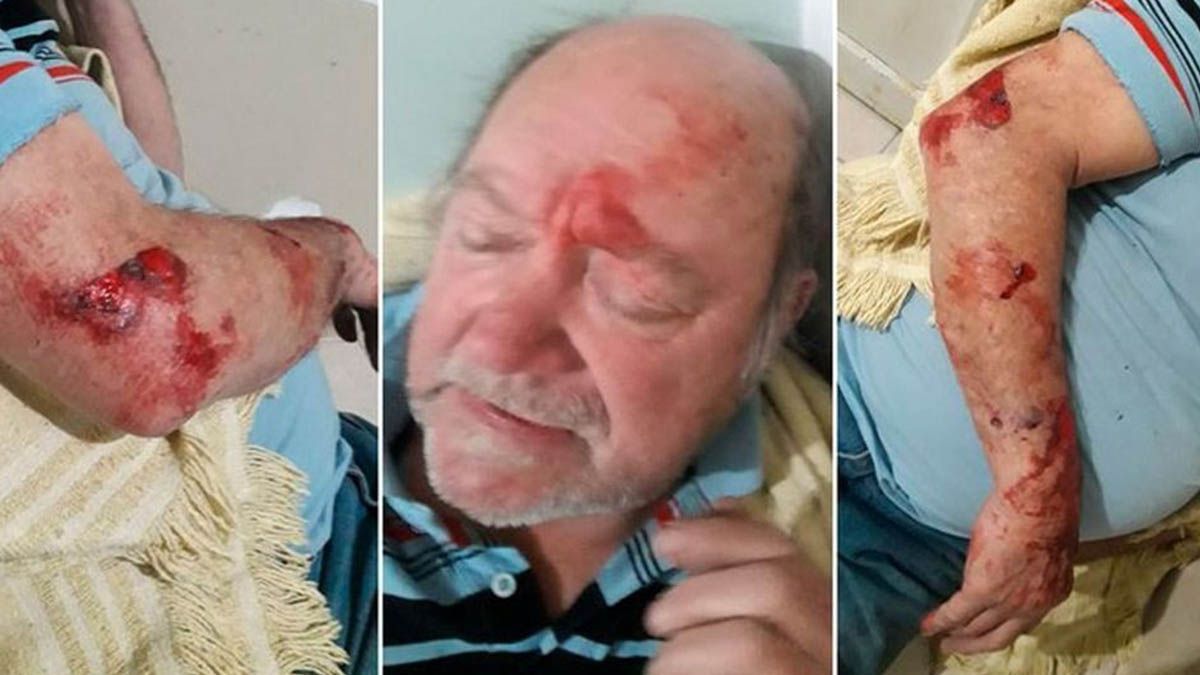 Las heridas del jubilado asaltado en su vivienda el fin de semana pasado.&nbsp;