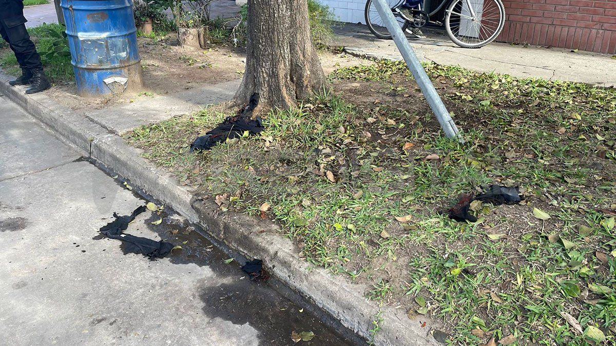 En diálogo con AIRE, el director del Cullen, Bruno Moroni, confirmó que el hombre “tiene el 50% del cuerpo quemado y pasó a terapia intensiva”. En diálogo con AIRE, el director del Cullen, Bruno Moroni, confirmó que el hombre “tiene el 50% del cuerpo quemado y pasó a terapia intensiva”.