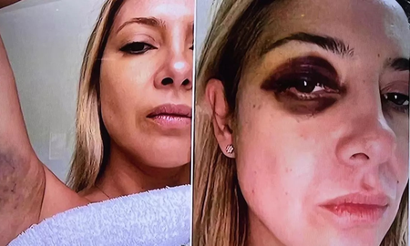 Se conocieron fotos de Fabiola Yáñez golpeada. Se conocieron fotos de Fabiola Yáñez golpeada.