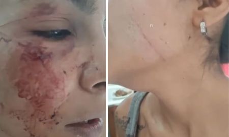 El ataque ocurrió en un descampado del límite entre los barrios Jorge Newbery y Carie. (Foto: 0223) El ataque ocurrió en un descampado del límite entre los barrios Jorge Newbery y Carie. (Foto: 0223)