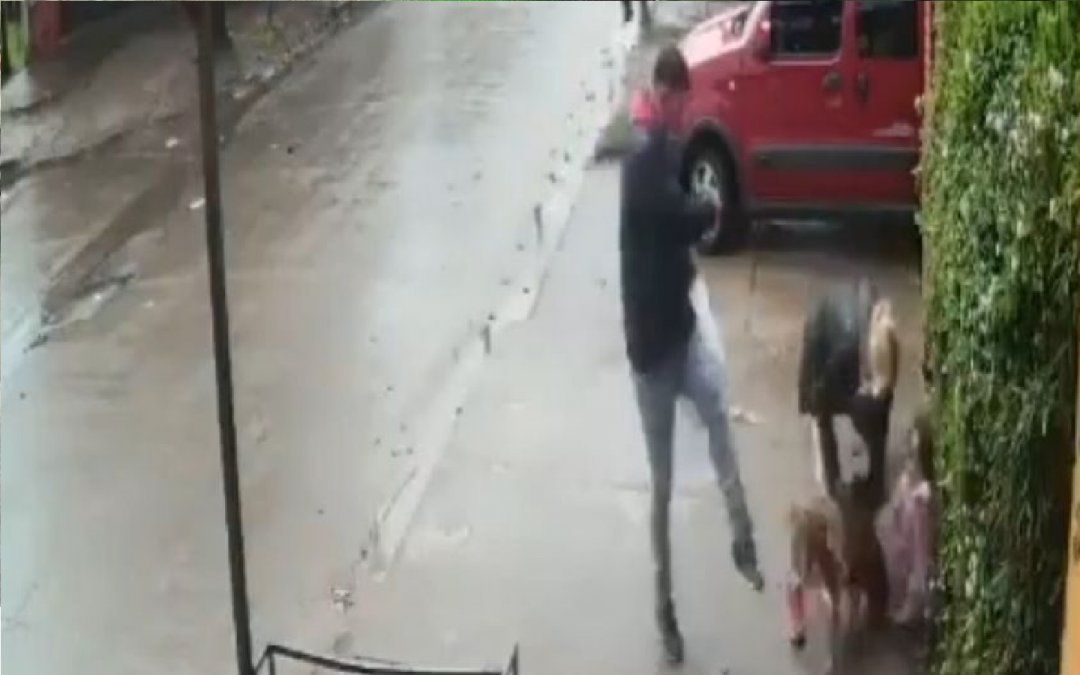 Un pitbull atacó a una nena y casi le arranca la pierna