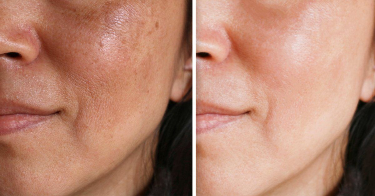 Una dieta para tu piel: cómo hacer “ayunar” a tu cara te dará una piel radiante