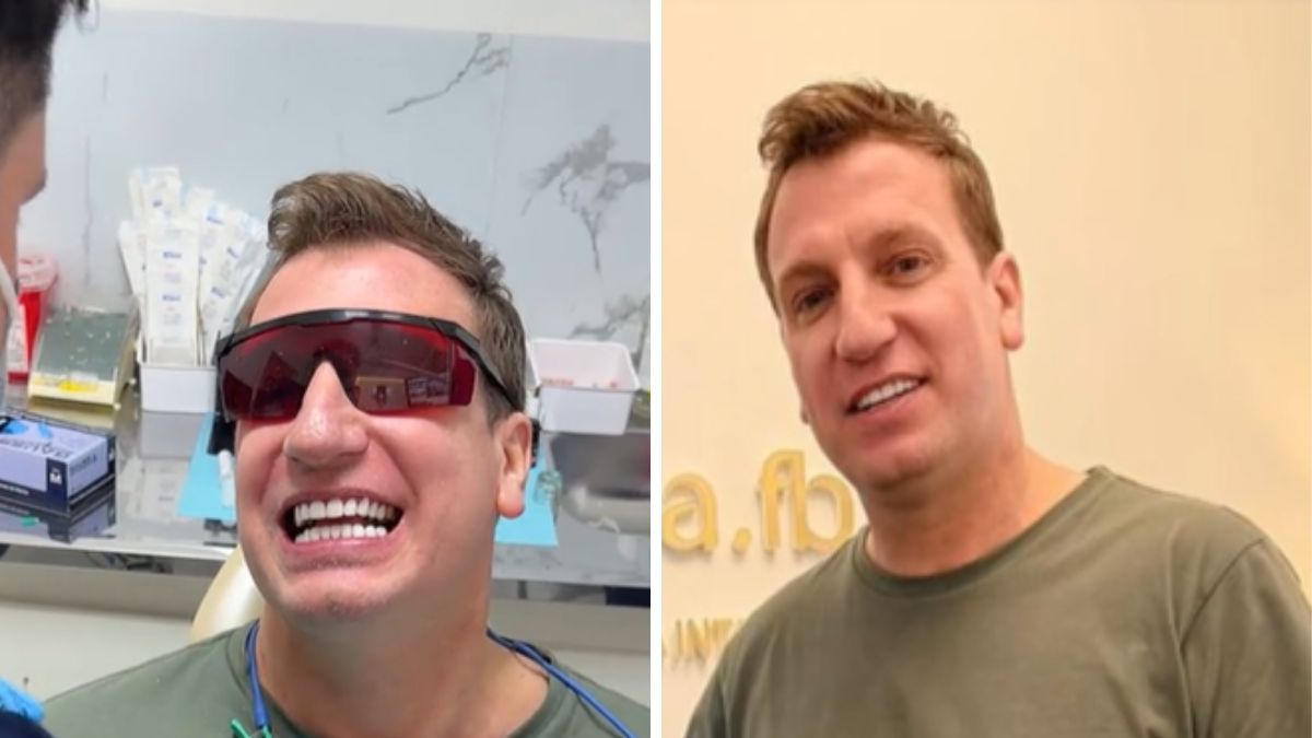 Maxi L&oacute;pez se realiz&oacute; un retoque est&eacute;tico en su dentadura.