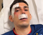 Gonzalo Escobar fue herido por hinchas de un equipo rival. Gonzalo Escobar fue herido por hinchas de un equipo rival.