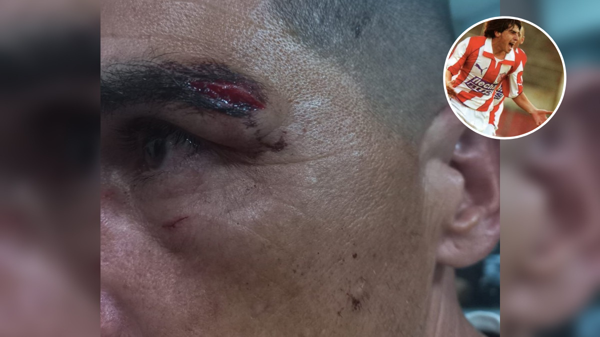 Agredieron al Memo Torres y a su mujer en plena tribuna de Unión: Me hicieron 3 puntos.