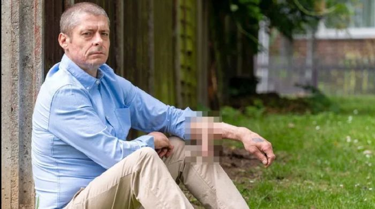 Malcolm MacDonald, un hombre de 47 años, vivió una de sus peores pesadillas cuando médicos le diagnosticaron una infección de sangre, la cual, posteriormente, causó que se le cayera su pene.