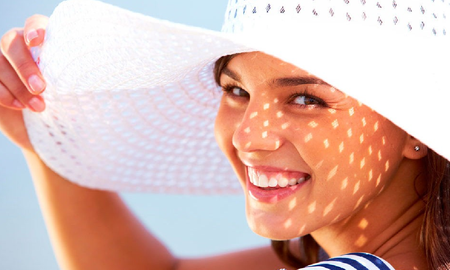 Consejos para evitar la aparición de manchas solares en verano