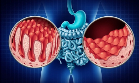el alimento ideal para personas celiacas el alimento ideal para personas celiacas