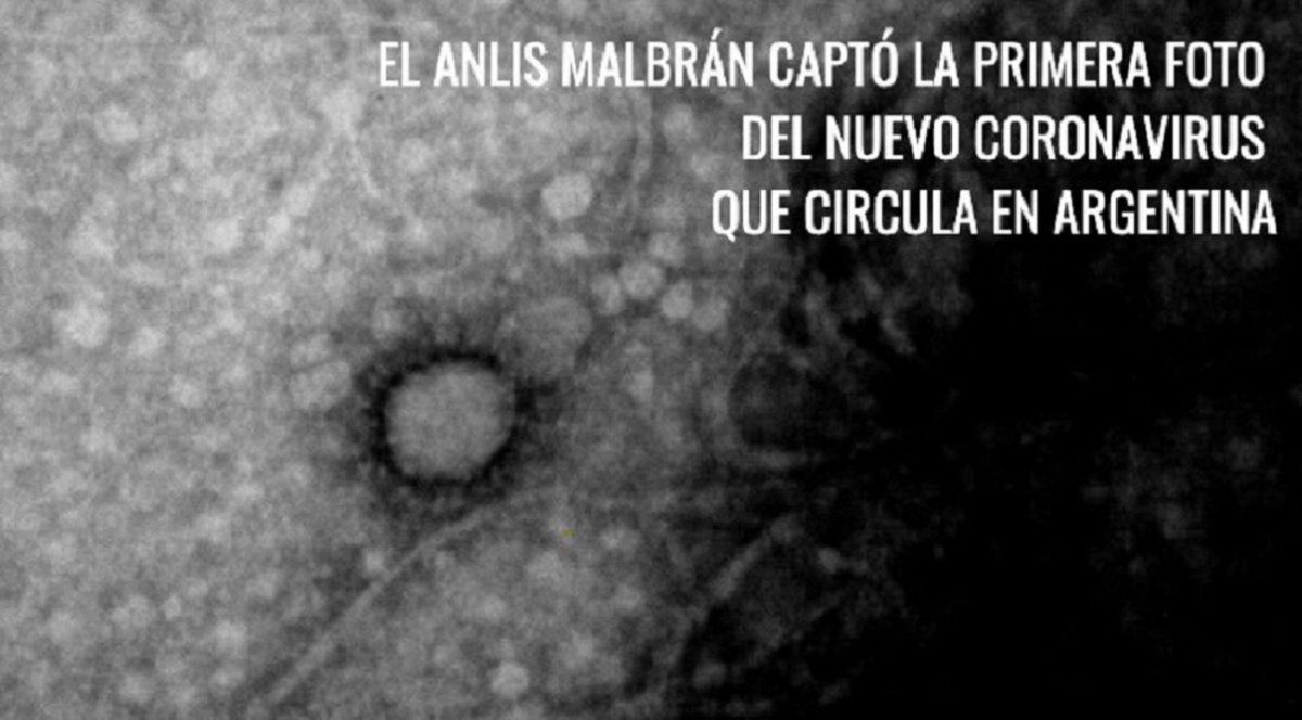 El ministro de salud twitteó la primera foto del virus SARS-CoV-2 que circula en Argentina