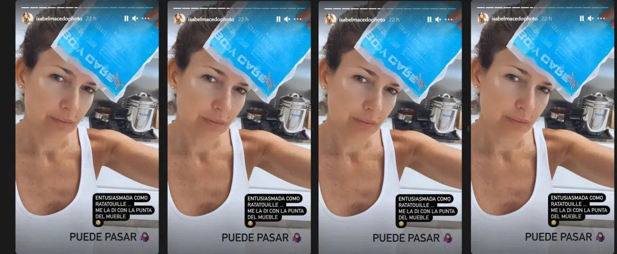 Isabel Macedo sufrió un pequeño accidente en la cocina.