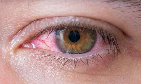 La enfermedad en los ojos que afecta a 300 mil argentinos