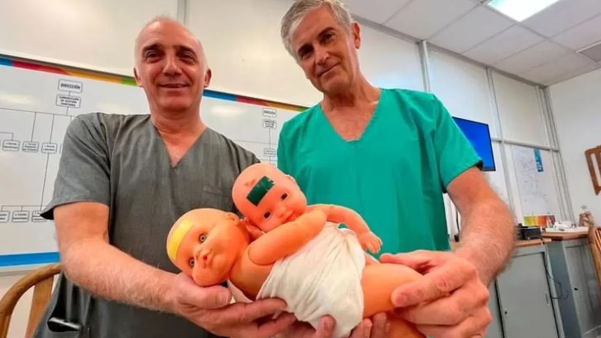 Los médicos que operaron a as gemelas
