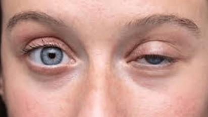 Qué significa que te palpite el ojo izquierdo