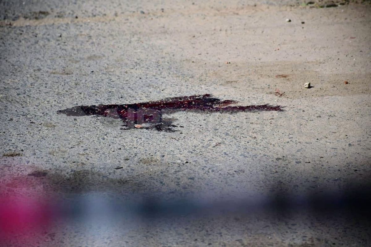 El hombre habría recibido un disparo en la frente. Se encuentra en estado delicado.