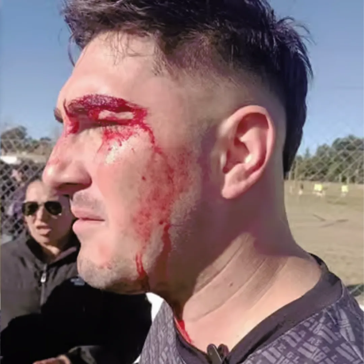 Un técnico de fútbol fue detenido tras agredir al árbitro durante un partido de la Liga Venadense. Un técnico de fútbol fue detenido tras agredir al árbitro durante un partido de la Liga Venadense.