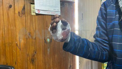 le dispararon en la mano