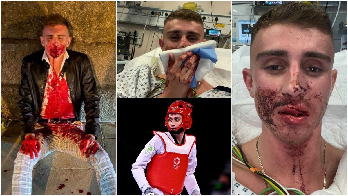 Jack decidió subir a sus redes sociales lo que le sucedió y se volvió viral.