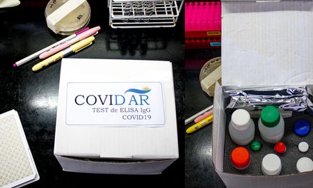 asi funciona el test argentino de coronavirus que estara disponible la proxima semana en el pais asi funciona el test argentino de coronavirus que estara disponible la proxima semana en el pais