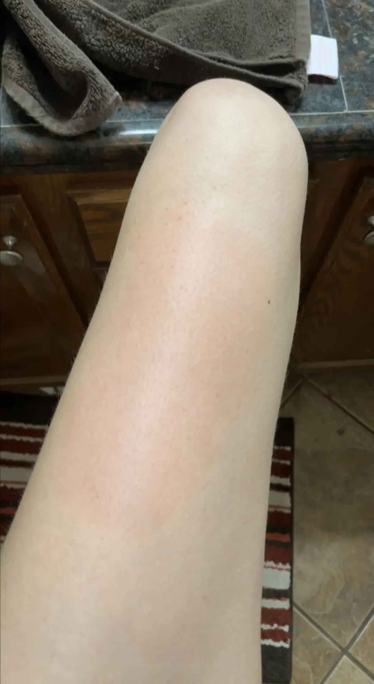 “Trato de mantenerme de buen humor, y sé que si algo sucediera, las personas que me rodean harán lo mejor que puedan”, agregó, señalando que tiene urticaria con frecuencia. 