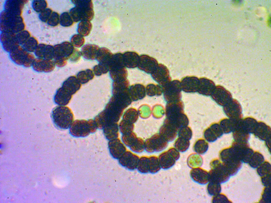 Dolichospermum circinale, especie de cianobacteria que frecuentemente hace floraciones visibles en superficie.