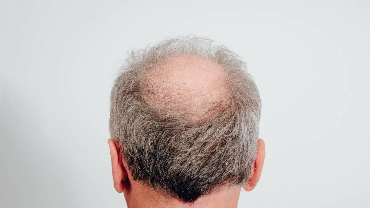 Un estudio en ratones mostró porqué pierden su pelaje. ¿Servirá para encontrar un remedio para los humanos?