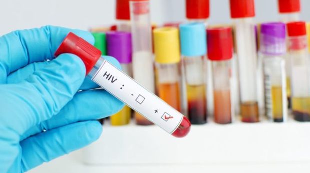 El test de HIV es gratuito, rápido y confidencial.