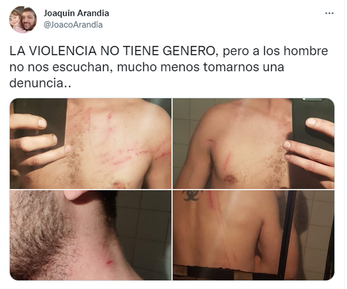 Un joven denunció violencia de género, se hizo viral y generó una ola de comentarios.