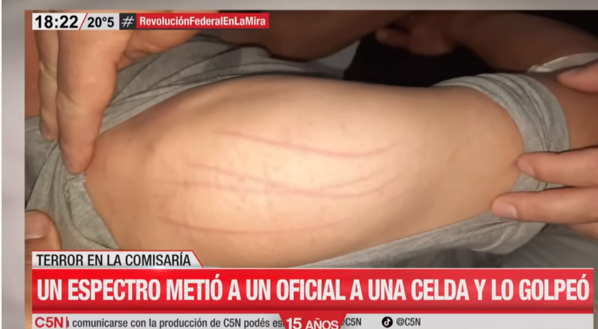 El extraño hecho ocurrió en la Departamental de Policía de esa ciudad entrerriana, donde la víctima sufrió lesiones, incluso una cruz marcada en la espalda con dedos.