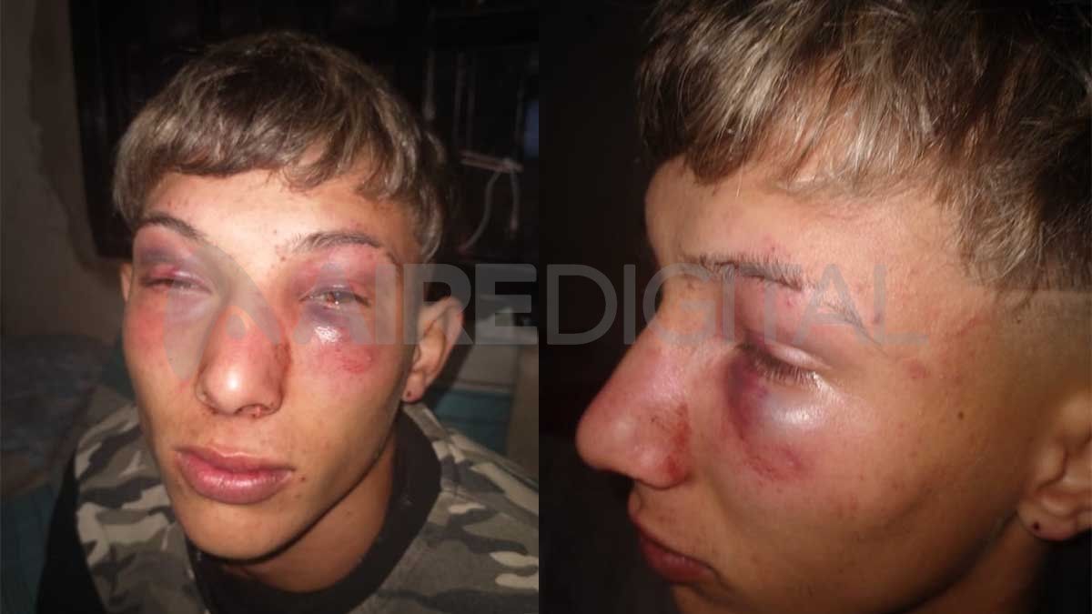 El rostro del joven la madrugada del domingo, luego de los fuertes golpes recibidos.