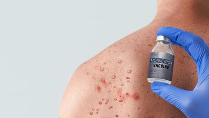 Sarampión: sin casos ni brotes confirmados en Santa Fe, refuerzan la vigilancia