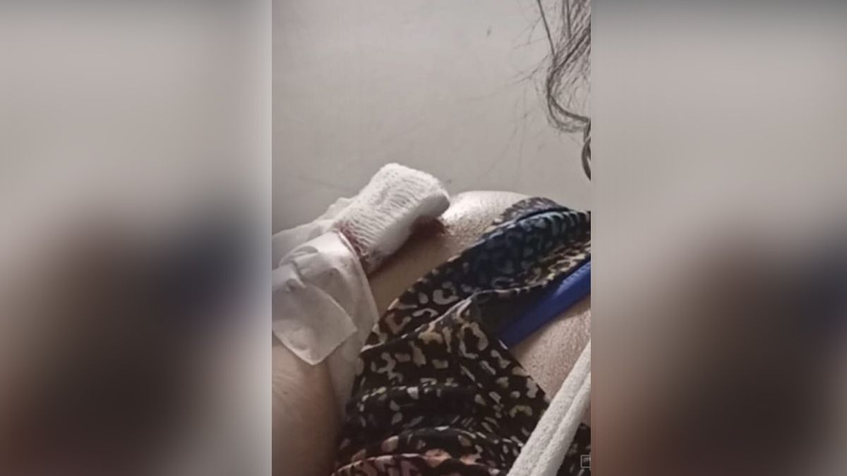 Así quedó la mujer que iba junto a Horacio en la moto. Así quedó la mujer que iba junto a Horacio en la moto.