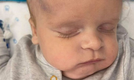 Un bebé recién nacido quedó con daño cerebral tras procedimiento durante el parto: usaron un clip de electrodo Un bebé recién nacido quedó con daño cerebral tras procedimiento durante el parto: usaron un clip de electrodo