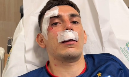 Gonzalo Escobar fue herido por hinchas de un equipo rival. Gonzalo Escobar fue herido por hinchas de un equipo rival.