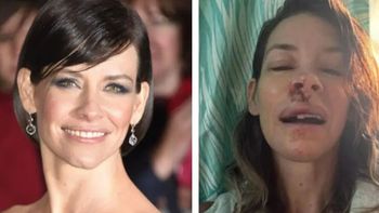 La actriz Evangeline Lilly reveló que sufre daño cerebral tras un accidente en una playa de Hawái