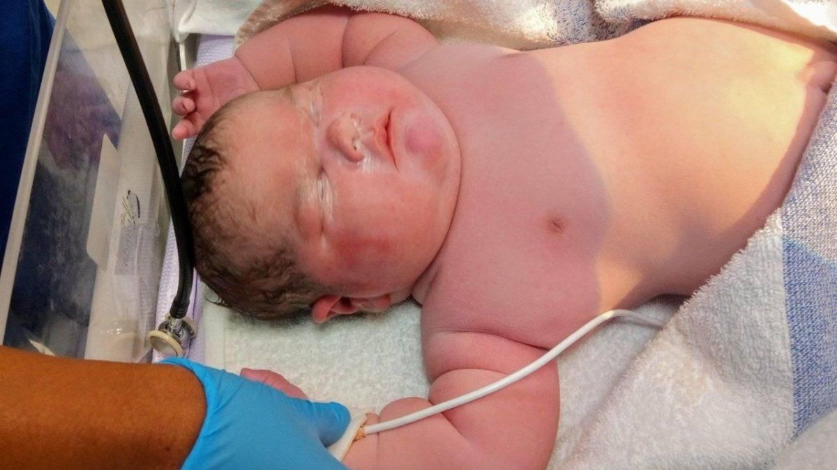 Todo el mundo se reía cuando salía la cabeza