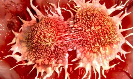 Avance contra el cáncer: científicos descubrieron la causa de la metástasis
