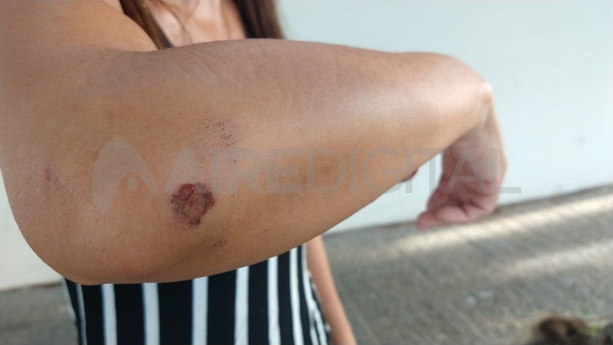 La mujer intentó resistirse al asalto y los ladrones la tumbaron al piso