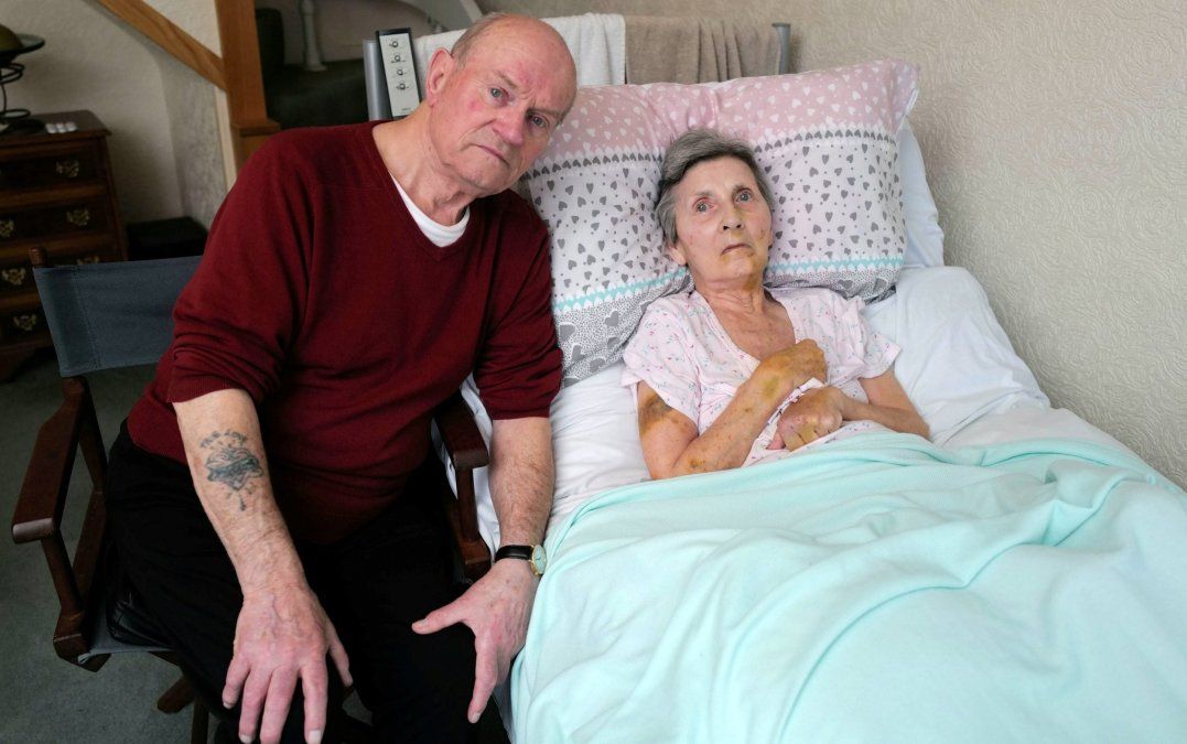 Una mujer con daño cerebral e inmovilidad motriz fue mordida en la cara por una rata mientras dormía