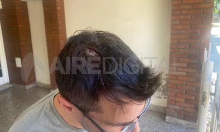 Los delincuentes atacaron a culatazos a Alejandro, que logró repeler el ingreso a la vivienda y contener a su familia. Los delincuentes atacaron a culatazos a Alejandro, que logró repeler el ingreso a la vivienda y contener a su familia.