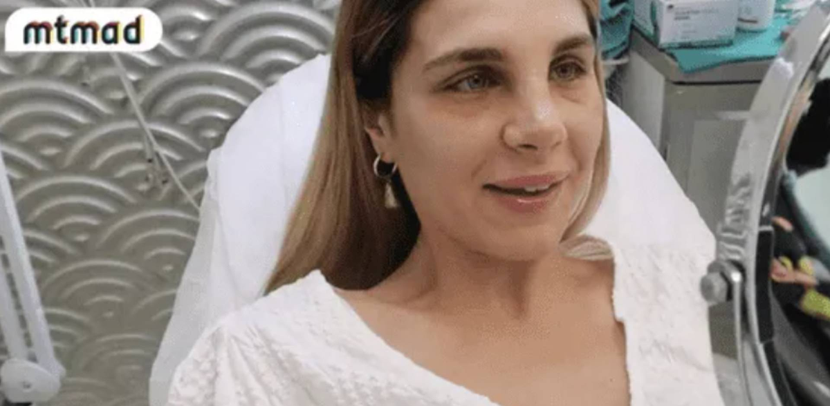 Ivana Icardi se hizo la nariz y mostró su nueva cara.