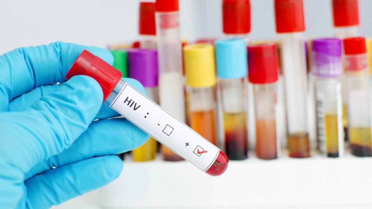 Día Mundial de Lucha contra el sida: 11.300 personas viven con VIH en la provincia de Santa Fe