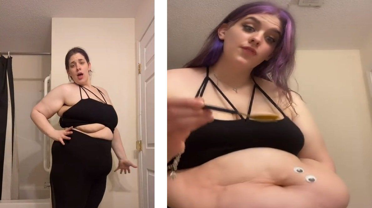 La joven que muestra el exceso de piel que le quedó tras adelgazar 50 kilos